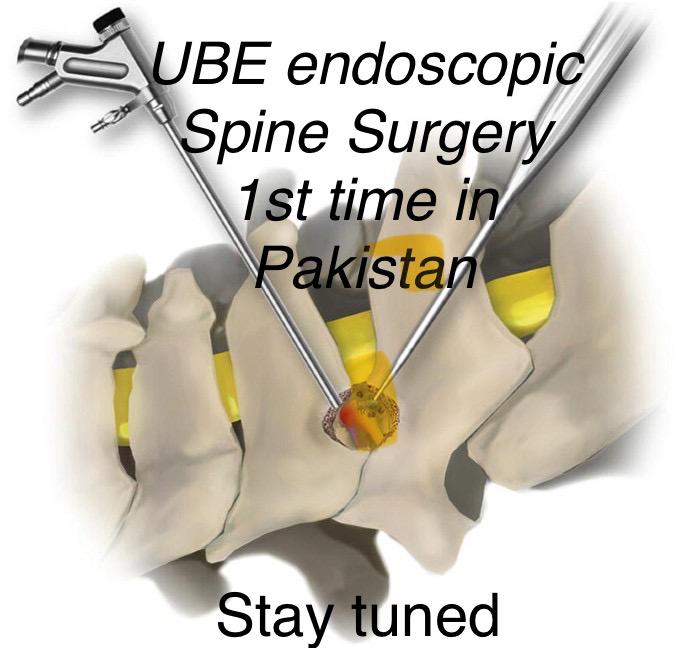UBE endoscopic spine surgery diagram